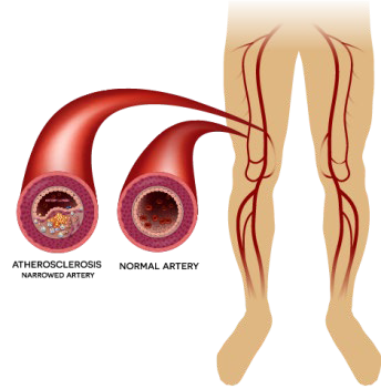 Leg vascular image